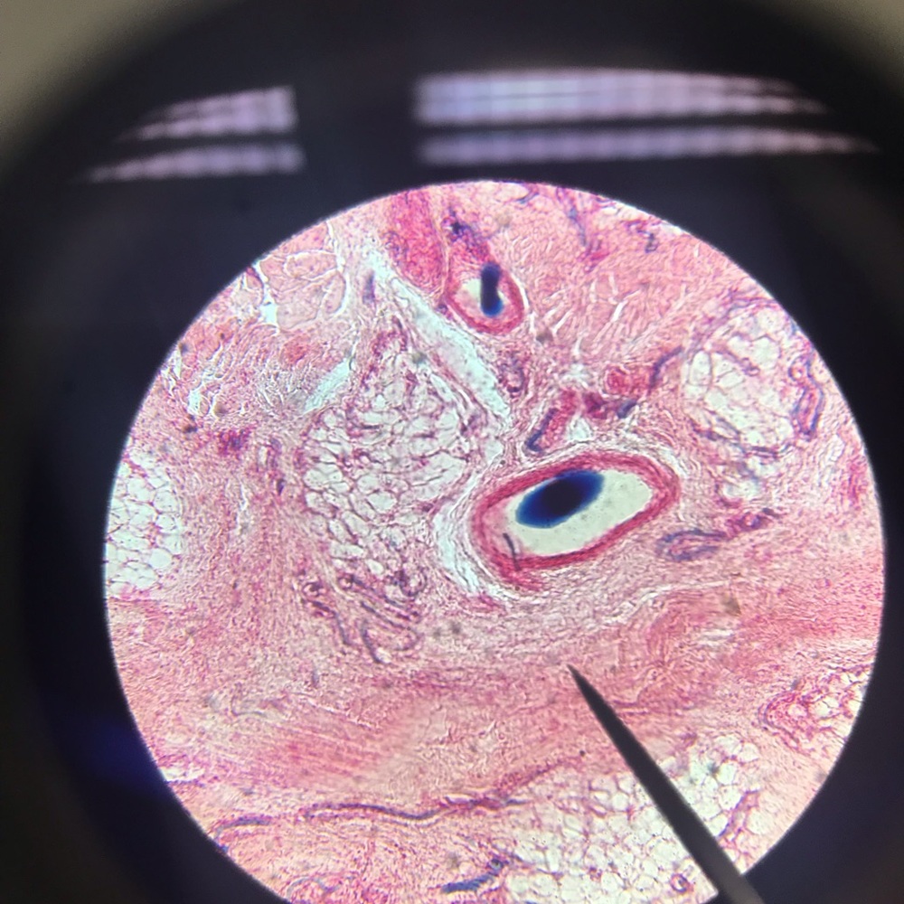 Meet your Posher, Ibeth